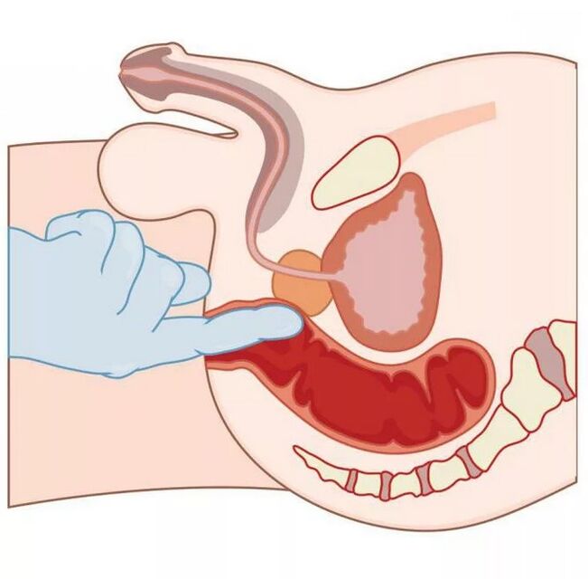 Männlech G-Plaz Standuert
